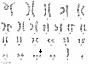 Хромосомы у кошки: количество, особенности, отклонения