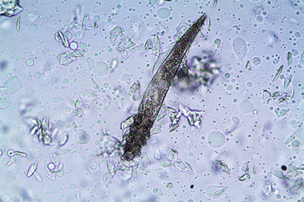 Demodex. Демодекс Канис в микроскопе. Клещ демодекс под микроскопом. Демодекс клещ микроскоп.