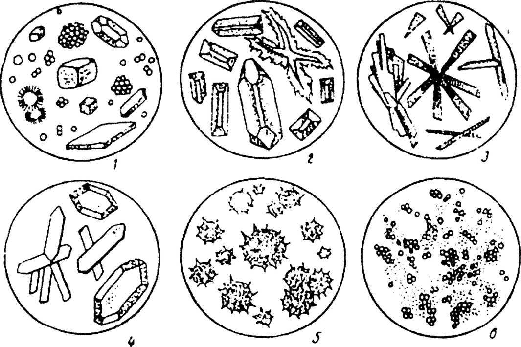 Бактерии и белки в моче. Микроскопия неорганизованного осадка мочи. При микроскопии осадка мочи соли. Микроскопия осадка мочи неорганизованный осадок. Микроскопия мочи Ураты.