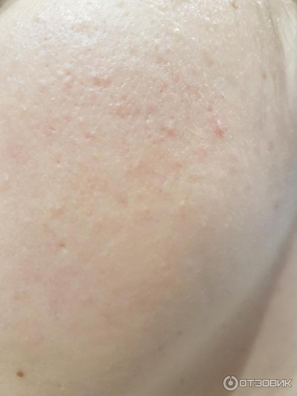 Как избавить кошку и котят от блох